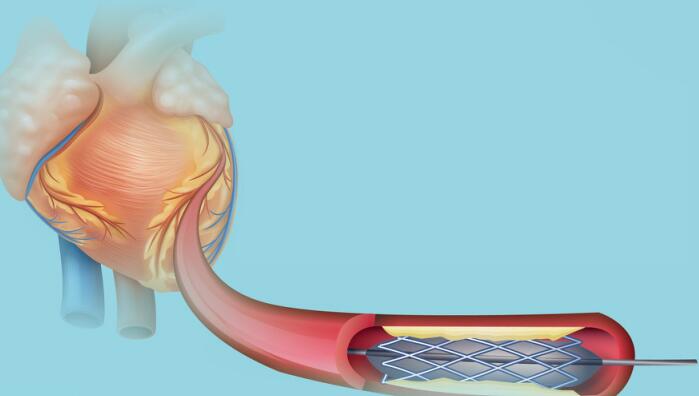 R5f882a5abef89a7d66f05c3e1b97367d.jpg R5f882a5abef89a7d66f05c3e1b97367d.jpg